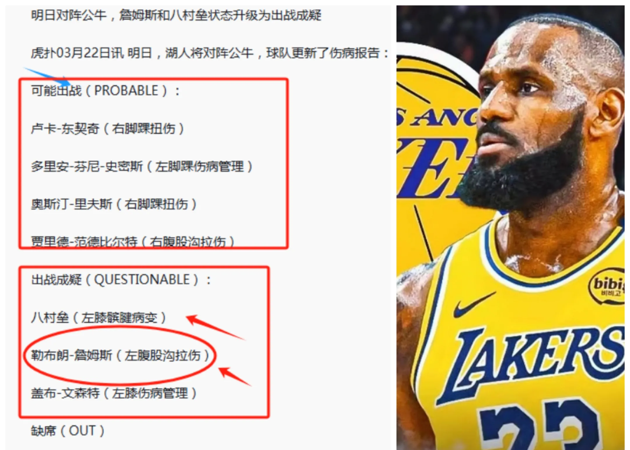 包含湖人队惨败后更衣室爆发冲突，主帅回应，说明业务您的回复一样.的词条